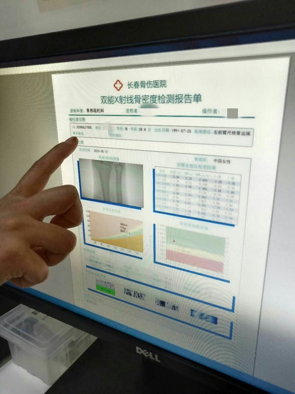 品源雙能X射線骨密度儀落戶吉林省長春骨傷醫(yī)院，助力骨松診療