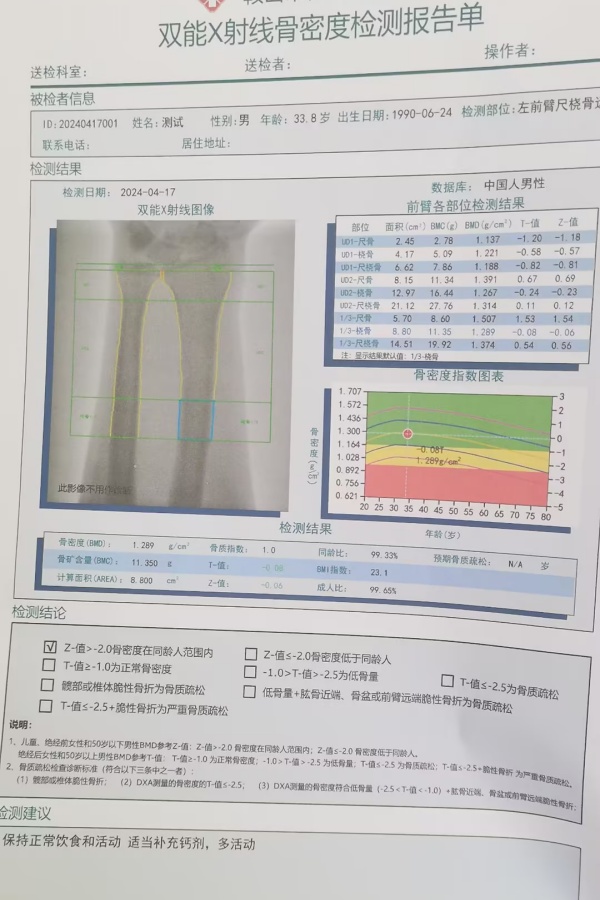 雙能X射線骨密度儀：準(zhǔn)確測量骨密度，助力骨質(zhì)疏松防治，守護(hù)骨骼健康